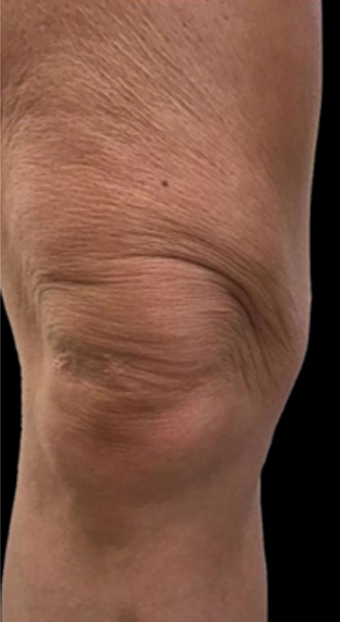 До